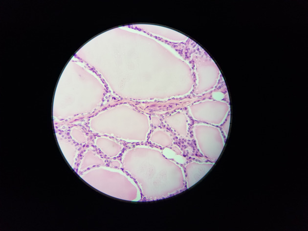 Parathyroid Thyroid Slides - Parathyroid_Thyroid 011 400X